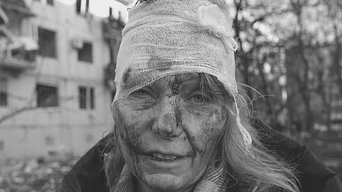 Ukrainian Teacher Who Survived Russian Missile Becomes Internet's Face of War