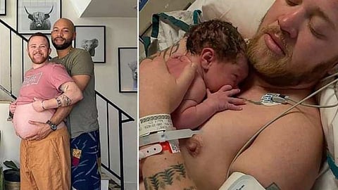 Transgender Man Gave Birth