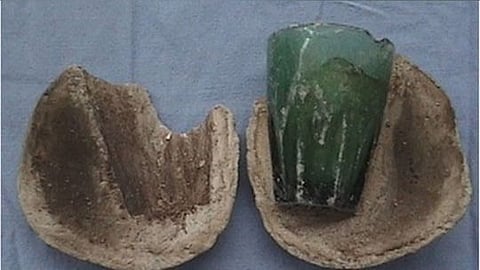 महिलेच्या प्रायव्हेट पार्टमध्ये ४ वर्षांपासून अडकला होता काचेचा तुकडा