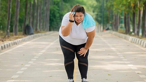 childhood trauma is genetics associated with increased risk of obesity Research