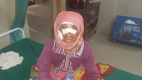 Wolf alike beast attack 7 injured