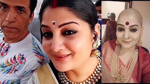 Dipti Dhyani shaves off her head for husband Sooraj Thapar