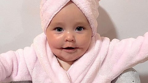 a baby born with permanent smile
