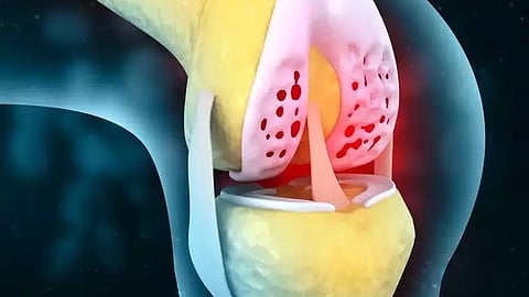 knee pain