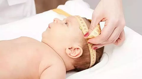 वयानुसार बाळाच्या डोक्याचा आकार किती असावा ? अतिवाढ कशाचे लक्षण ?