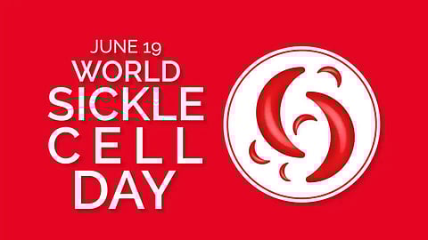 Health world sickle cell day 2022