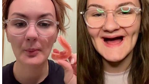 31 Year old woman looks like 80 years old