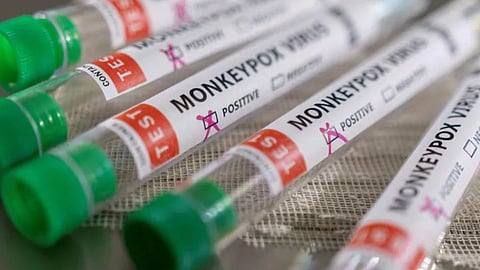 monkeypox Outbreak in france 1700 case reported mostly gay