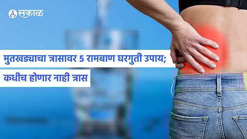 Home Remedies for Kidney Stone