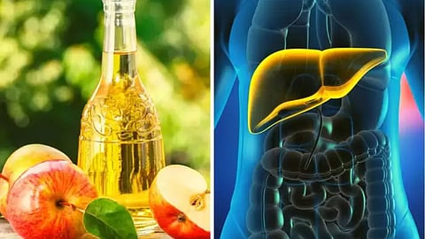 Apple Cider Vinegar Tips