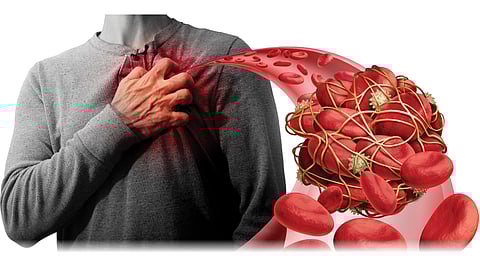 blood vessels get blocked