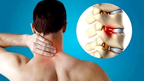 Cervical Pain