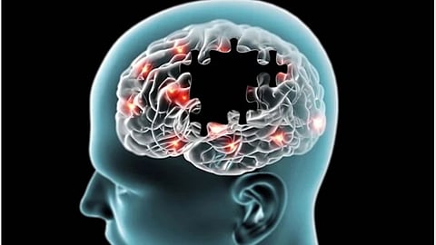 World Alzheimer's Day