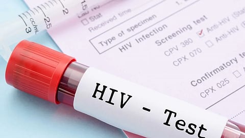 AIDS Testing Center