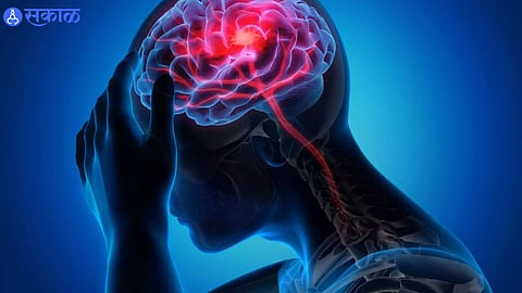 Brain Stroke: ब्रेन स्ट्रोकच्या उपचारांसाठी रेडी स्ट्रोक युनिट