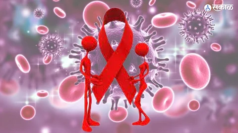 HIV Aids Symptoms