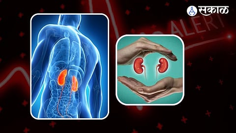 Kidney Diseases