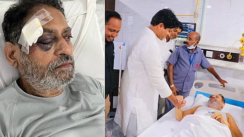 nitin raut on congress bharat jodo yatra eye injury incident in hyderabad