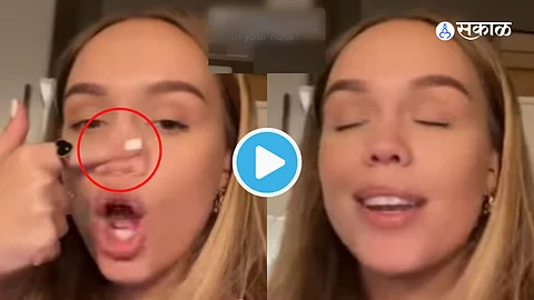 Viral Video