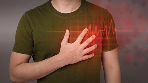 heart attack