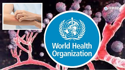 Fungal Disease
