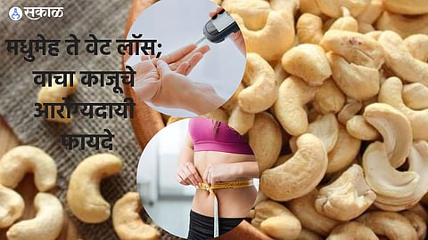 Cashew Benefits
