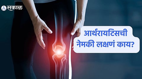 Arthritis Tips : आर्थरायटिसबद्दल प्रत्येकाला 'हे' माहिती असायलाच हवे