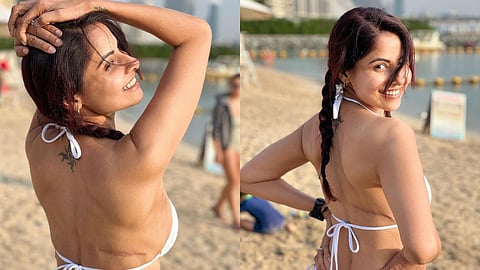 Chaavi Mittal flaunts her breast cancer scars, says..this is what earned in 2022.