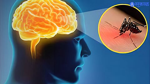 Japanese Encephalities