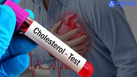 Cholesterol Levels
