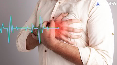 Heart Attack