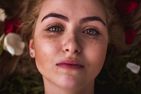 Vitamin Deficiency Dark Spots