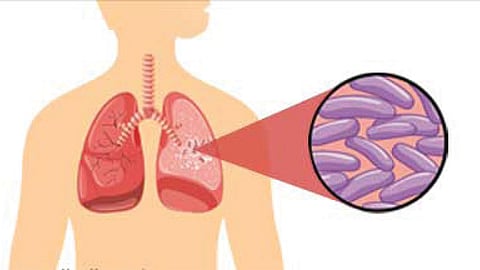 tuberculosis patients