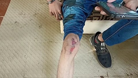 Accident