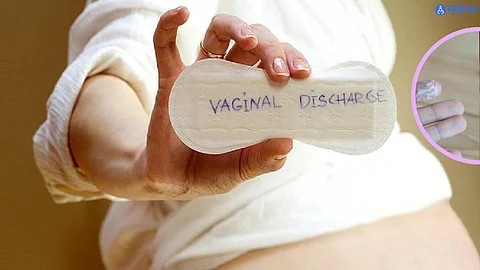 White Discharge