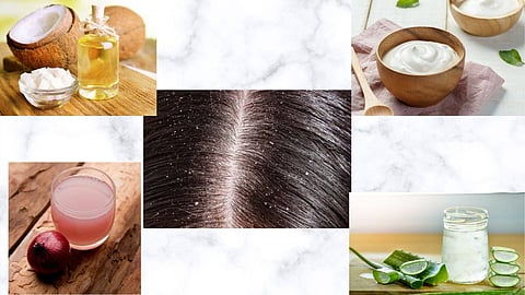 Winter Hair Care Tips