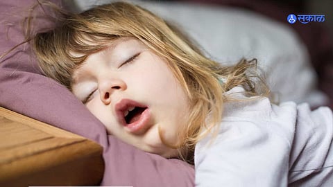 Mouth Breathing problem