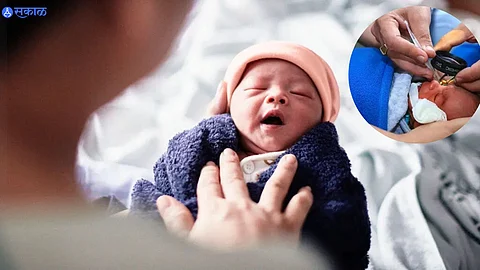 Retinopathy of prematurity