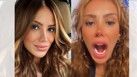 model ceyda ersoy got hospitalized after first kiss gone wrong on date needed surgery on her tongue