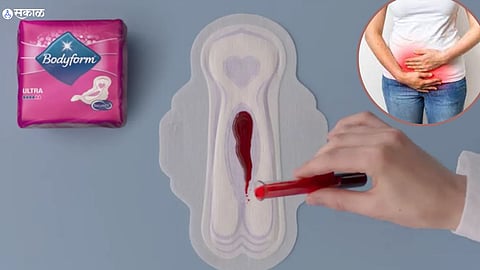 Menstrual Hygiene