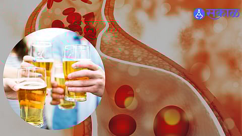 Cholesterol and Beer