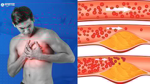 Cholesterol Level In Male