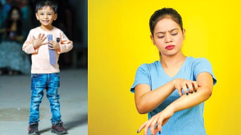 skin care child health Hyper active