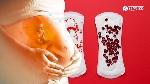 bleeding during pregnancy