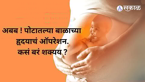 heart surgery of a baby in a womb