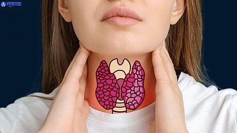 Thyroid Symptoms