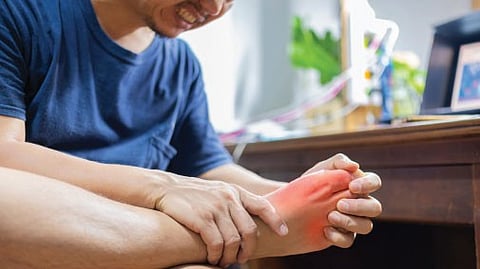 health doctor Do not afraid of uric acid