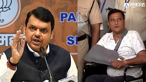 Sandeep Deshpande Attack