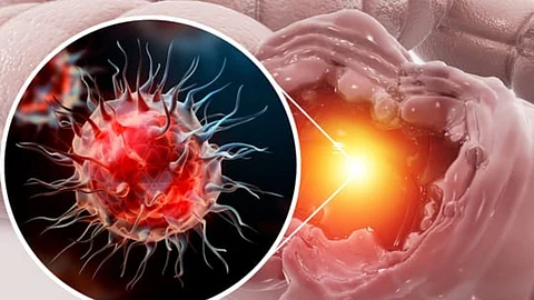 Weight Loss and Cancer