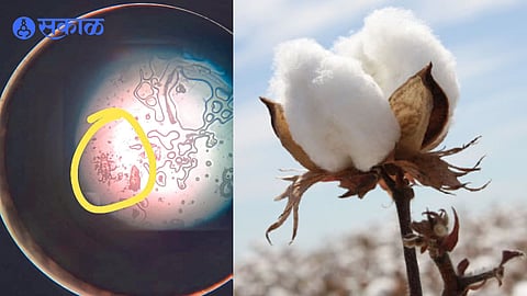 Itching disorders due to stored cotton to farmers jalgaon news